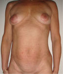 Small