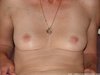Photos des seins de Archamp, archamp1