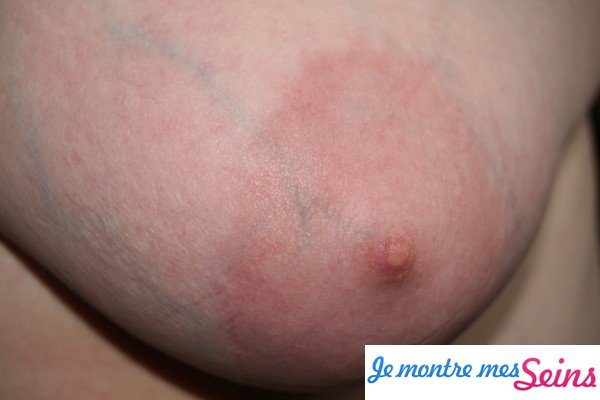 Photo des seins de Laurent
