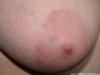 Photos des seins de Laurent, laurent3