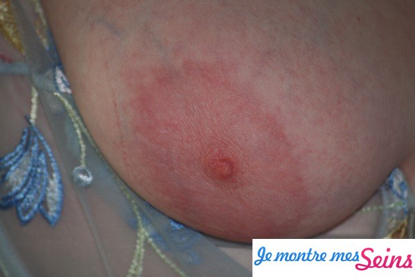 Photo des seins de Laurent