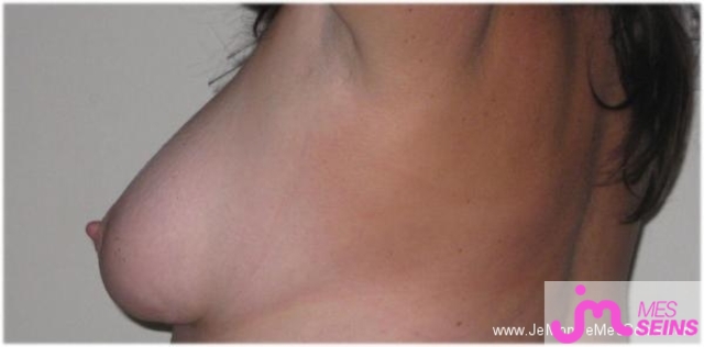 Photo des seins de Bouboule