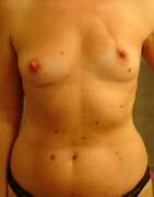 Photos des seins de Kylie, Kylie 1