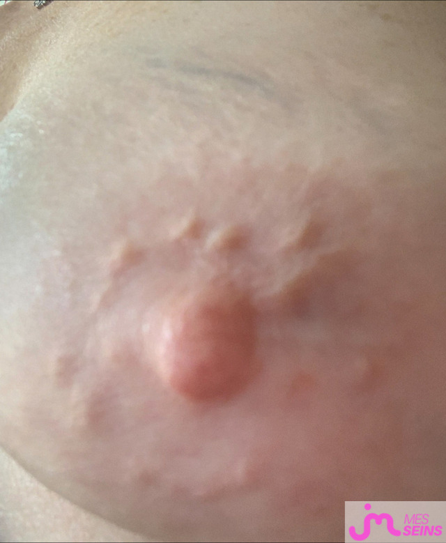 Les gros seins de Ret