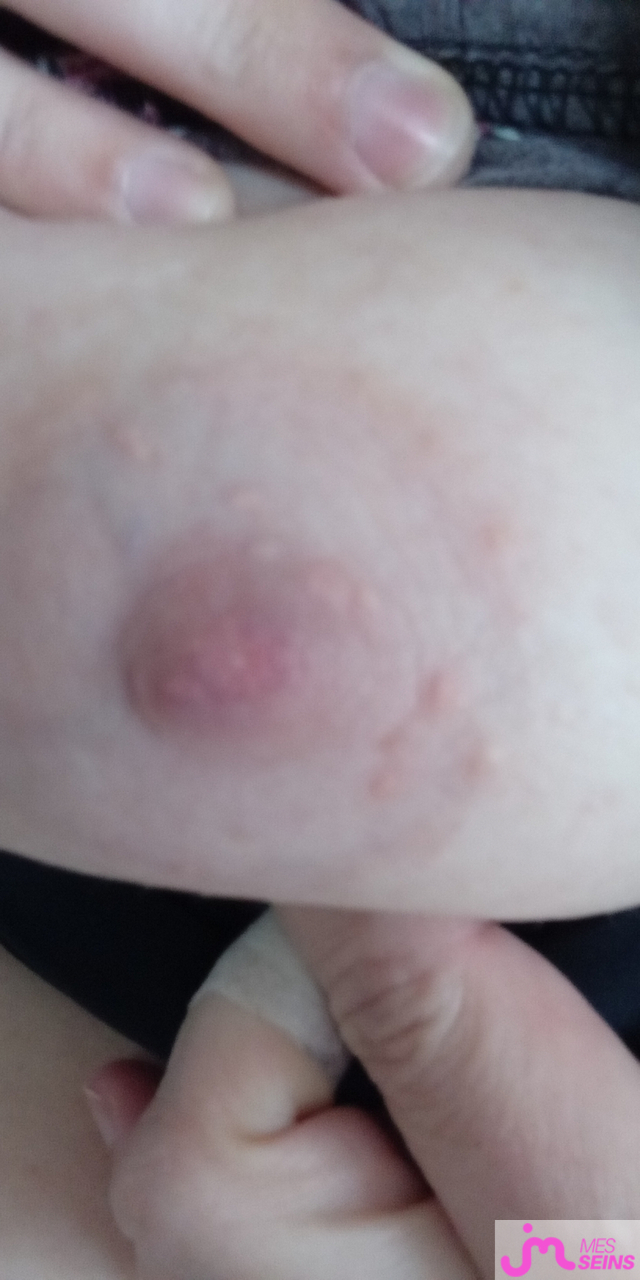 Les seins moyens de Fier