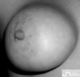 Photos de seins : Sans artifice