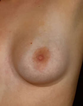 Photos de seins : Première photo 