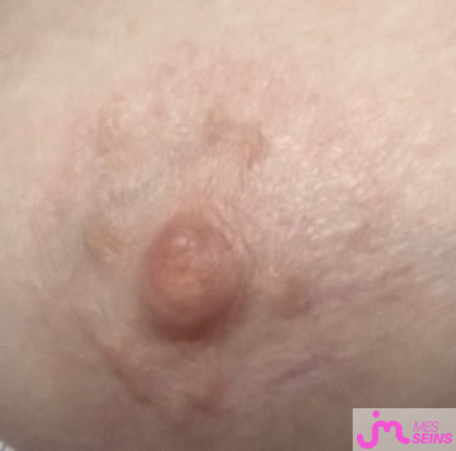 Les gros seins de Raou