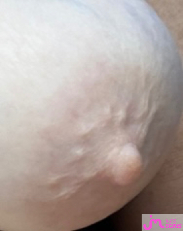 Les gros seins de Raou