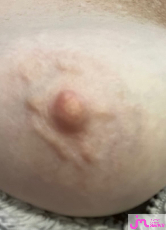 Les gros seins de Raou