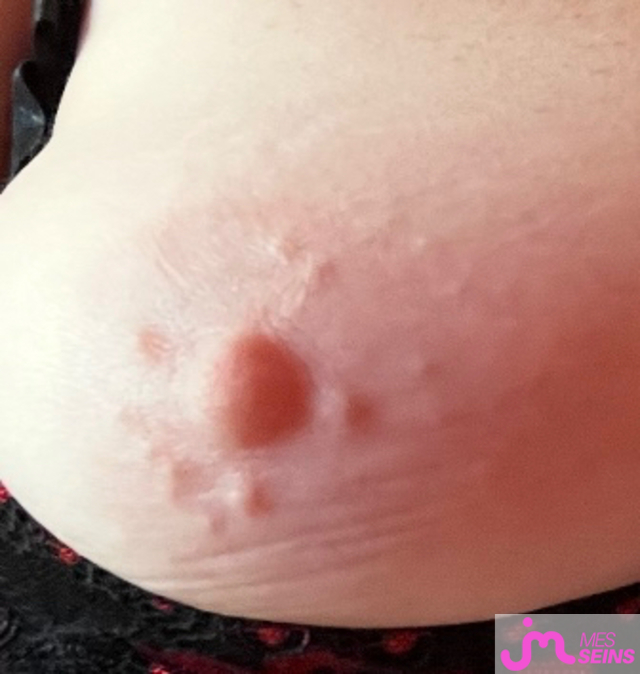 Les gros seins de Raou