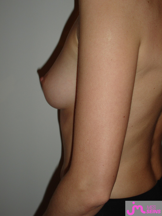 Les seins moyens de Aurore2025