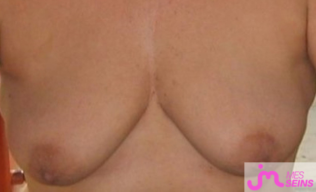 Les seins moyens de Elsah