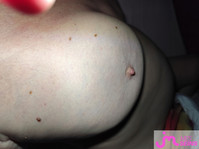 Les gros seins de V&eacute;rofleurs