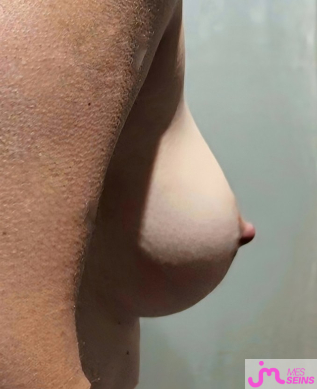 Les gros seins de elias74