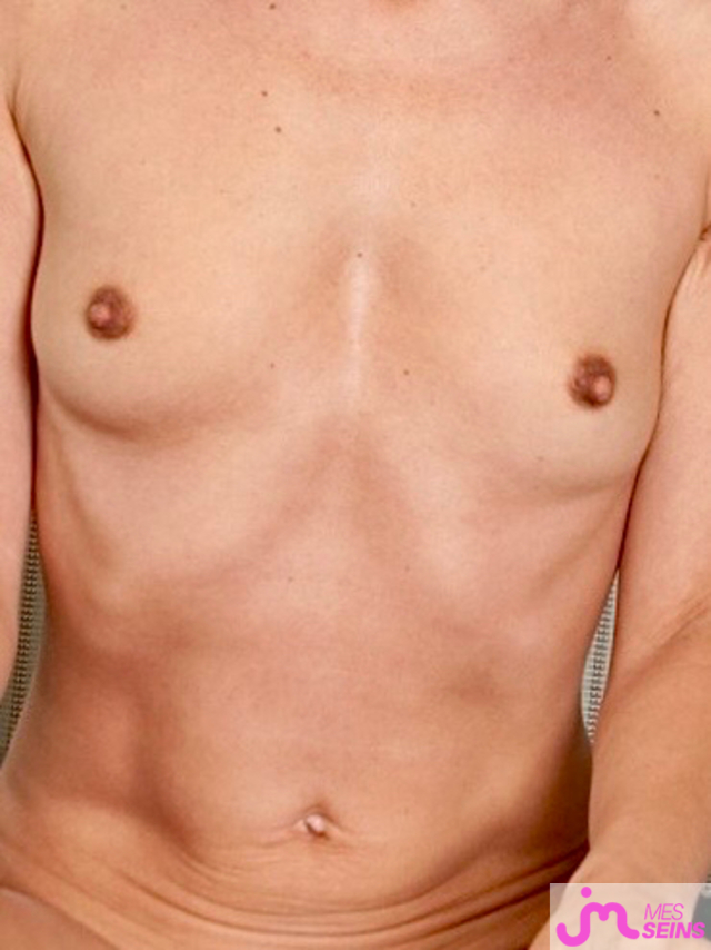 Les petits seins de 13x13