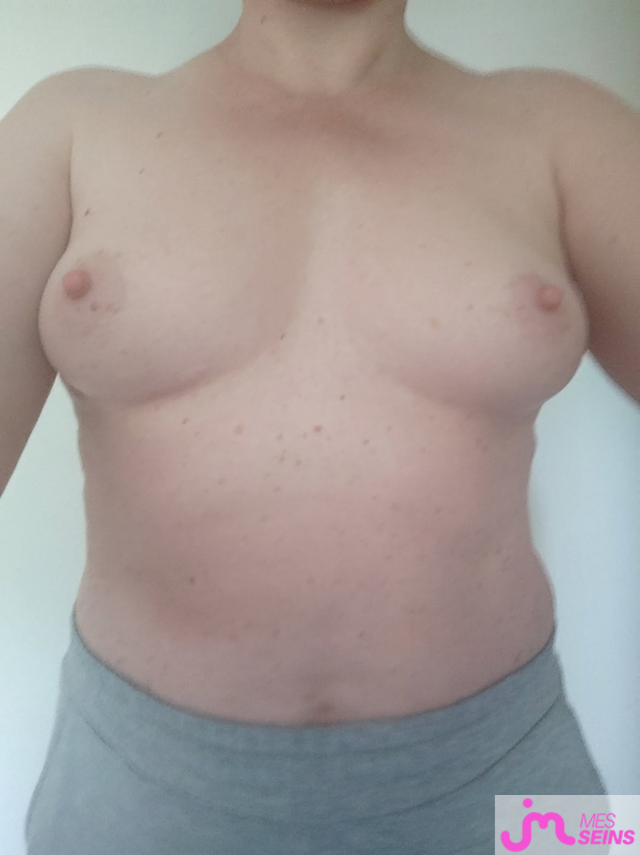 Les seins moyens de carole de rouen