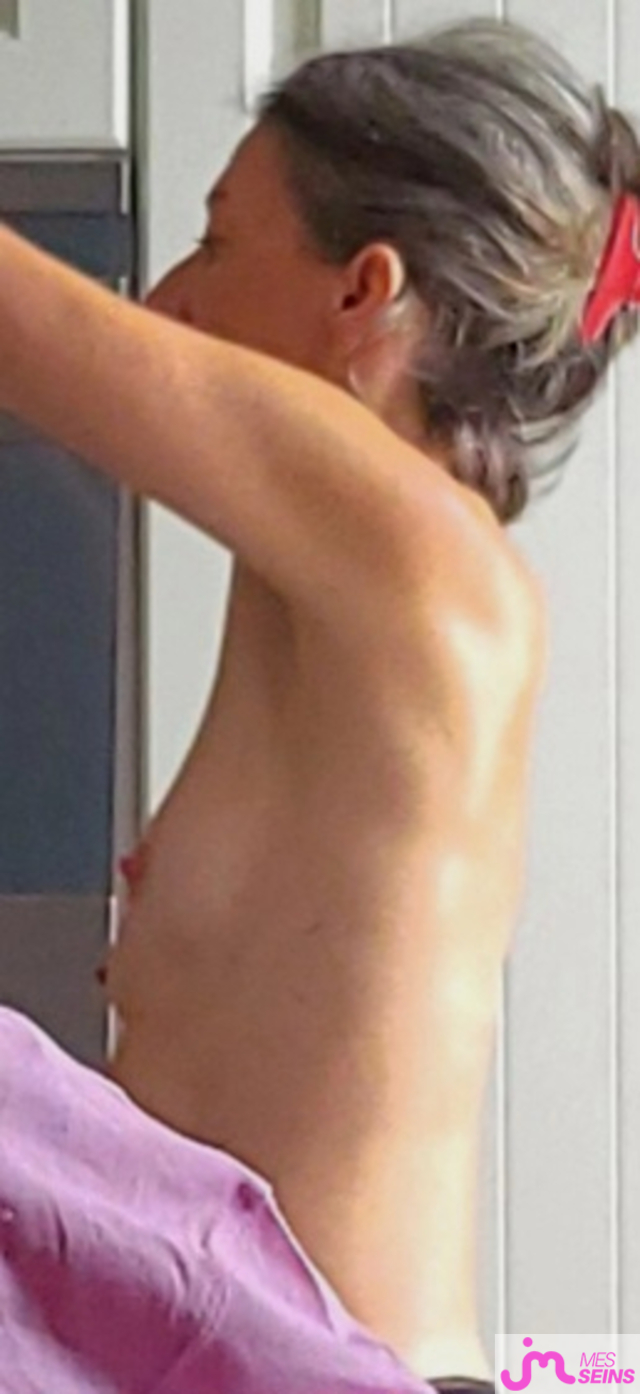 Les seins moyens de Niphard