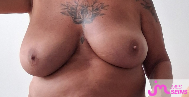 Photos de seins : Nouvelle s&eacute;rie